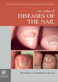 E-book An Atlas of Diseases of The Nail