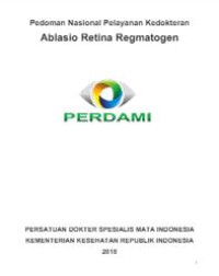 E-book Ablasio Retina Regmatogen